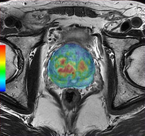 egories-do-not-clone-advanced-visualization-applications-bodyview-aw-bodyview_overview_jpg