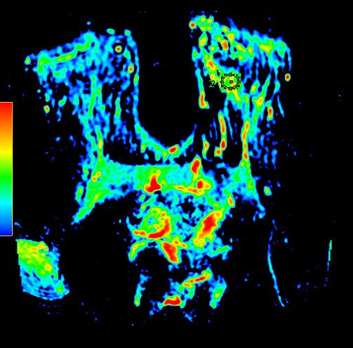 Image clinique avec oncoquant.
