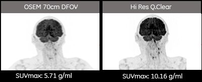 product-product-categories-molecular-imaging-discovery mi -new-small lesion 1.png