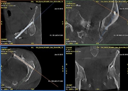 bone-interventional-assess.png