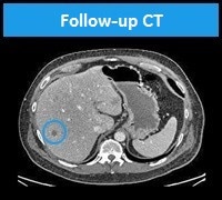 product-product-categories-pet-ct-discover mi image gallery-tab image 4 new.jpg