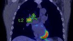 visualisation avancée image clinique avec pet vcar