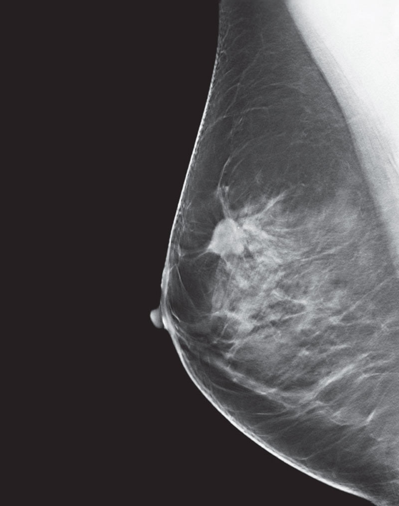 Ge 3d mammography system Ge 3d mammography system picture