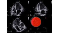 Solutions De Cardiologie Ge Sante Solutions De Cardiologie Ge Sante