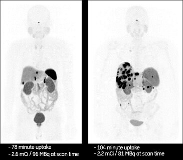 product-product-categories-molecular-imaging-discovery mi -new-small lesion 3b.png