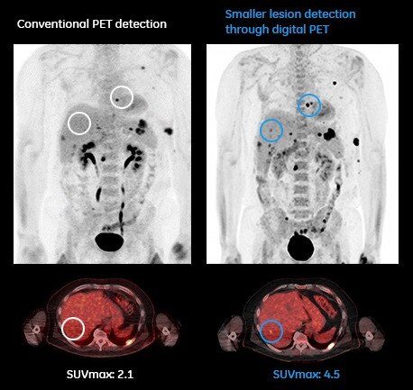 product-product-categories-pet-ct-discover mi image gallery-tab image new.jpg