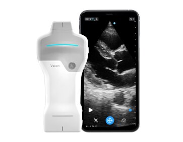 GE Healthcare Vscan ハンディスキャナー Vscan Air™ SL | GE HealthCare