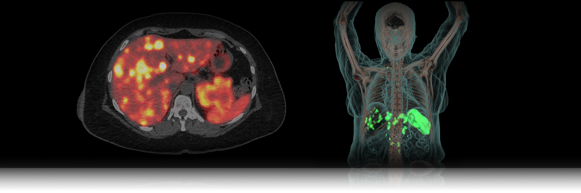 GEHC MI Landing Page Updates PET Radiopharmacy Image 1