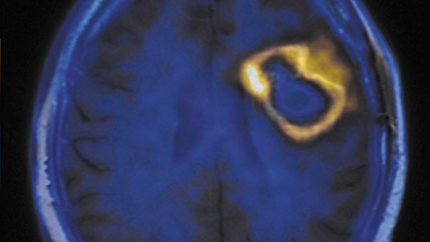 advanced visualization integrated registration.