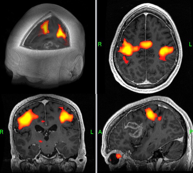 GE Santé Brainwave
