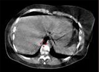 -product-categories-nuclear-medicine-spect-ct scanners-discovery 670 new-smallerimage1.png