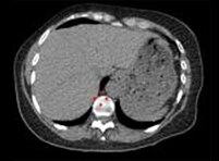 -product-categories-nuclear-medicine-spect-ct scanners-discovery 670 new-smallerimage2.png
